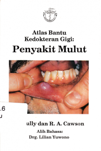 Atlas Bantu Kedokteran Gigi : Penyakit Mulut